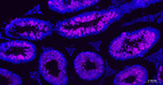 Nrf2 Antibody in Immunohistochemistry (Paraffin) (IHC (P))