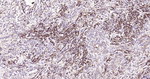 Nrf2 Antibody in Immunohistochemistry (Paraffin) (IHC (P))