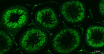 Nrf2 Antibody in Immunohistochemistry (Paraffin) (IHC (P))
