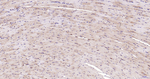 Nrf2 Antibody in Immunohistochemistry (Paraffin) (IHC (P))