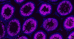 Nrf2 Antibody in Immunohistochemistry (Paraffin) (IHC (P))