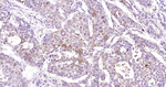 Nrf2 Antibody in Immunohistochemistry (Paraffin) (IHC (P))