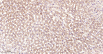 Nrf2 Antibody in Immunohistochemistry (Paraffin) (IHC (P))