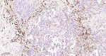 Nrf2 Antibody in Immunohistochemistry (Paraffin) (IHC (P))