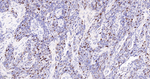 KIFC1 Antibody in Immunohistochemistry (Paraffin) (IHC (P))