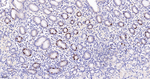 KIFC1 Antibody in Immunohistochemistry (Paraffin) (IHC (P))