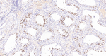 KIFC1 Antibody in Immunohistochemistry (Paraffin) (IHC (P))