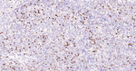 KIFC1 Antibody in Immunohistochemistry (Paraffin) (IHC (P))