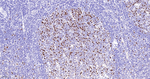 KIFC1 Antibody in Immunohistochemistry (Paraffin) (IHC (P))