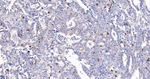 KIFC1 Recombinant Rabbit Monoclonal Antibody (12D2)
