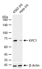 KIFC1 Antibody in Western Blot (WB)