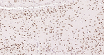 Phospho-CREB (Ser133) Antibody in Immunohistochemistry (Paraffin) (IHC (P))