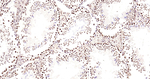 Phospho-CREB (Ser133) Antibody in Immunohistochemistry (Paraffin) (IHC (P))