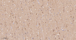 Phospho-PP2A alpha (Ser307) Antibody in Immunohistochemistry (Paraffin) (IHC (P))