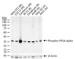Phospho-PP2A alpha (Ser307) Antibody in Western Blot (WB)