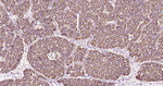 SHH Antibody in Immunohistochemistry (Paraffin) (IHC (P))