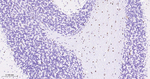 OLIG2 Antibody in Immunohistochemistry (Paraffin) (IHC (P))