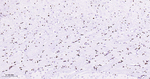 OLIG2 Antibody in Immunohistochemistry (Paraffin) (IHC (P))