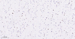 OLIG2 Antibody in Immunohistochemistry (Paraffin) (IHC (P))