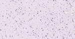 OLIG2 Antibody in Immunohistochemistry (Paraffin) (IHC (P))