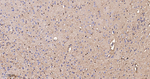 ENO1 Antibody in Immunohistochemistry (Paraffin) (IHC (P))
