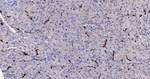 ENO1 Antibody in Immunohistochemistry (Paraffin) (IHC (P))
