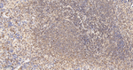 ENO1 Antibody in Immunohistochemistry (Paraffin) (IHC (P))