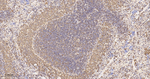 ENO1 Antibody in Immunohistochemistry (Paraffin) (IHC (P))