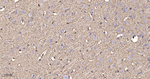 ENO1 Antibody in Immunohistochemistry (Paraffin) (IHC (P))