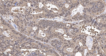 ENO1 Antibody in Immunohistochemistry (Paraffin) (IHC (P))