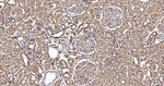 ENO1 Antibody in Immunohistochemistry (Paraffin) (IHC (P))