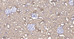 ENO1 Antibody in Immunohistochemistry (Paraffin) (IHC (P))