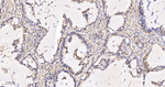 ENO1 Recombinant Rabbit Monoclonal Antibody (9B16)