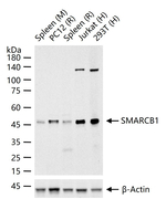 SMARCB1 Recombinant Rabbit Monoclonal Antibody (11F11)