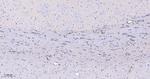 Plectin Antibody in Immunohistochemistry (Paraffin) (IHC (P))