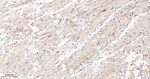 Plectin Antibody in Immunohistochemistry (Paraffin) (IHC (P))