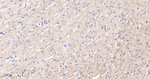 Plectin Antibody in Immunohistochemistry (Paraffin) (IHC (P))