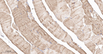 Plectin Recombinant Rabbit Monoclonal Antibody (2A5)