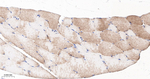 Plectin Antibody in Immunohistochemistry (Paraffin) (IHC (P))