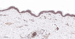 Plectin Antibody in Immunohistochemistry (Paraffin) (IHC (P))