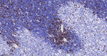 TACC3 Antibody in Immunohistochemistry (Paraffin) (IHC (P))