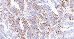 TACC3 Antibody in Immunohistochemistry (Paraffin) (IHC (P))