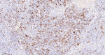 TACC3 Antibody in Immunohistochemistry (Paraffin) (IHC (P))