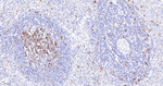 TACC3 Antibody in Immunohistochemistry (Paraffin) (IHC (P))