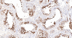 TACC3 Antibody in Immunohistochemistry (Paraffin) (IHC (P))