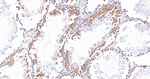 TACC3 Antibody in Immunohistochemistry (Paraffin) (IHC (P))