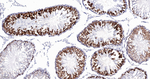 TACC3 Antibody in Immunohistochemistry (Paraffin) (IHC (P))