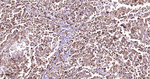 PMEL Antibody in Immunohistochemistry (Paraffin) (IHC (P))