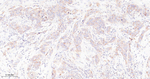 cIAP2 Antibody in Immunohistochemistry (Paraffin) (IHC (P))