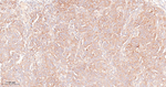 cIAP2 Antibody in Immunohistochemistry (Paraffin) (IHC (P))
